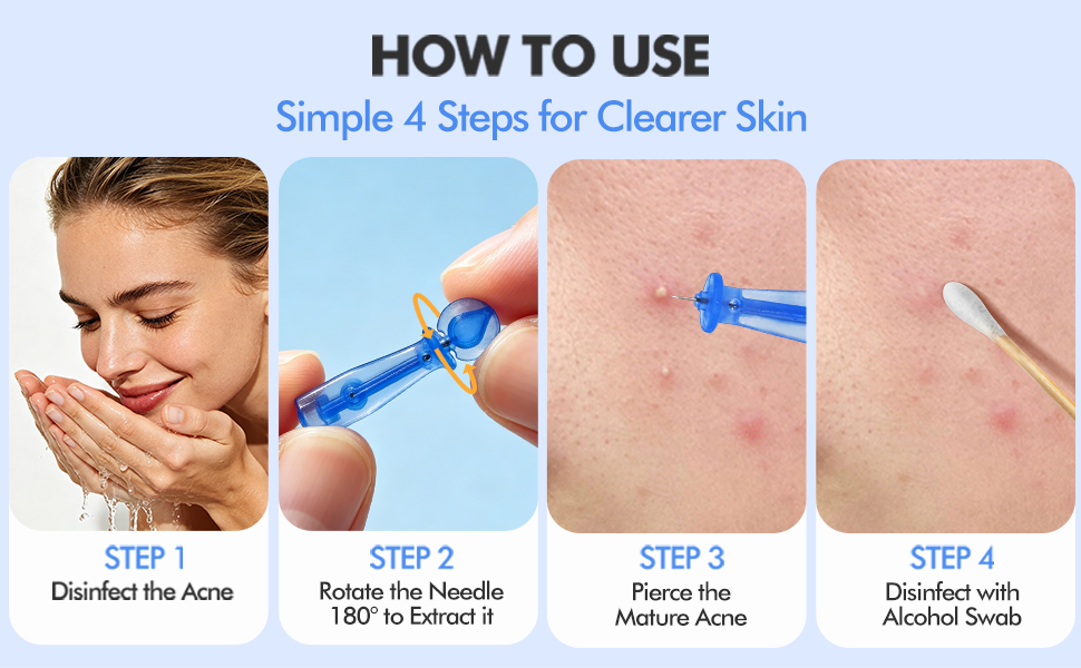 Professional Disposable Blackhead and Blemish Remover Tools
