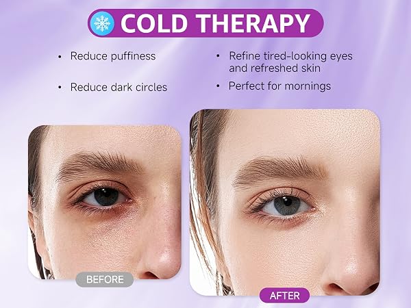 3. ice roller for face women