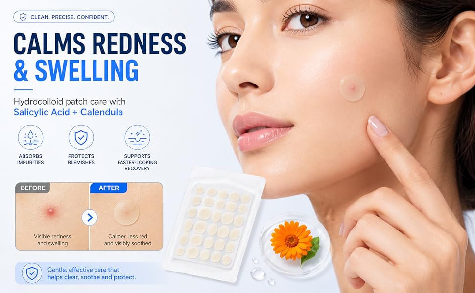pimple needle