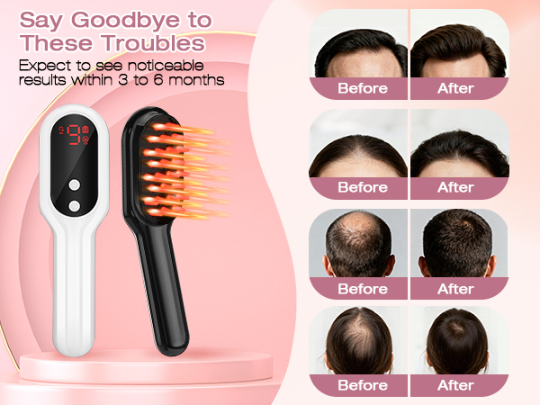 sniden hair growth spray