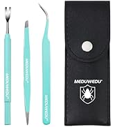 MEDUWEDU Tick Removal Tool Kit for Dogs, Cats &amp; Humans – Stainless Steel Tick Tweezer, Fork &amp; Dua...