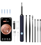 Ear Wax Removal - Earwax Remover Tool with 7 Pcs Ear Set - Ear Cleaner with Camera - Earwax Remov...