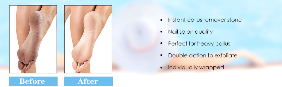 pedicure tools