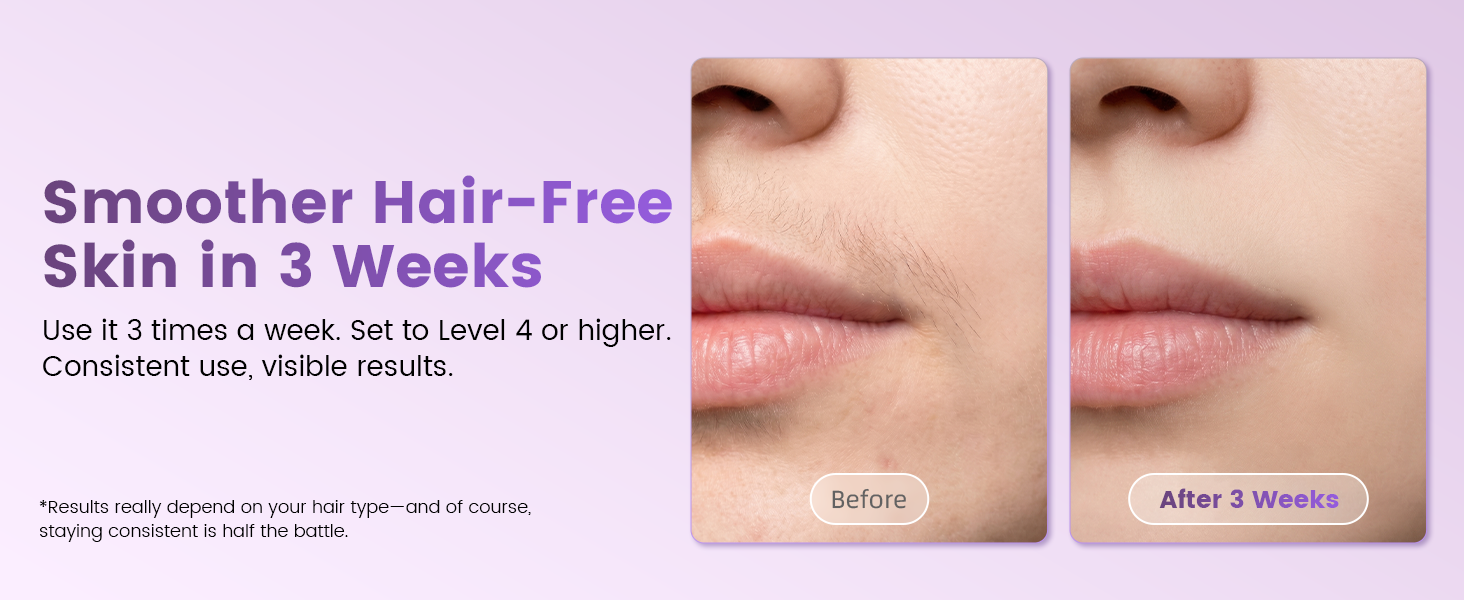 hair removal