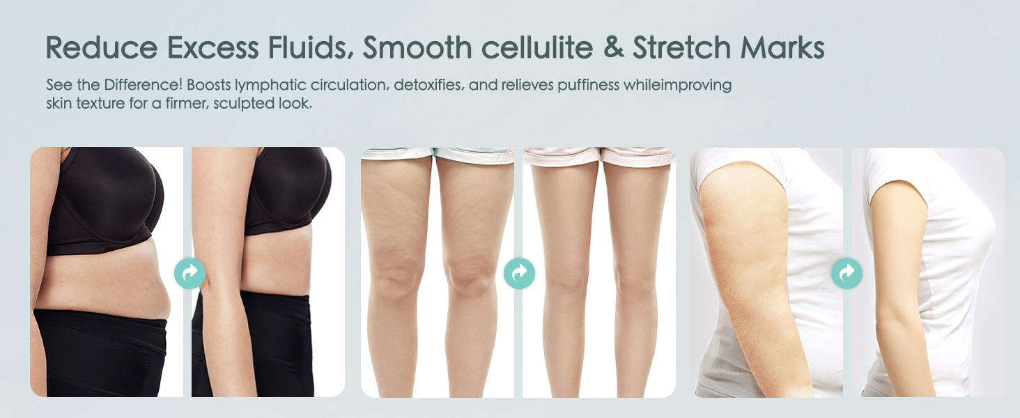 cellulite massage tool