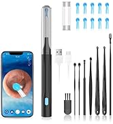 Wax Removal Tool for Ears, Earwax Remover Tools with 1080P Camera &amp; 6LED Light &amp; 8 Pcs Ear Set, E...