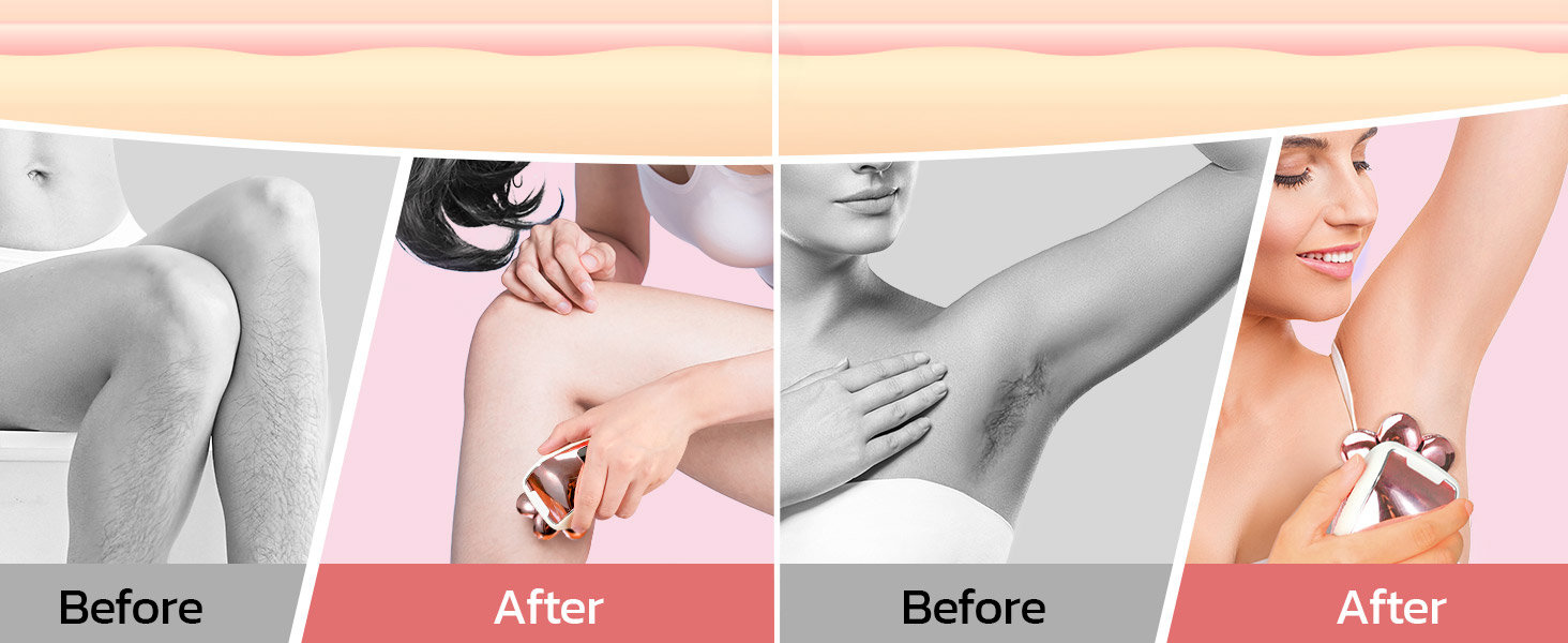 Electric Razors for Women Legs