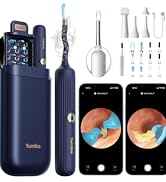 Ear Wax Removal Tool Camera, Visible Ear Cleaner Earwax Remover Kit with Tweezers, Flexible Ear S...