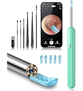 Loyker Ear Wax Removal Tool Camera, Ear Cleaner with 1080P Camera, Earwax Removal Cleaning Kit wi...