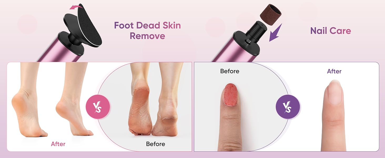 foot scrubber dead skin remover