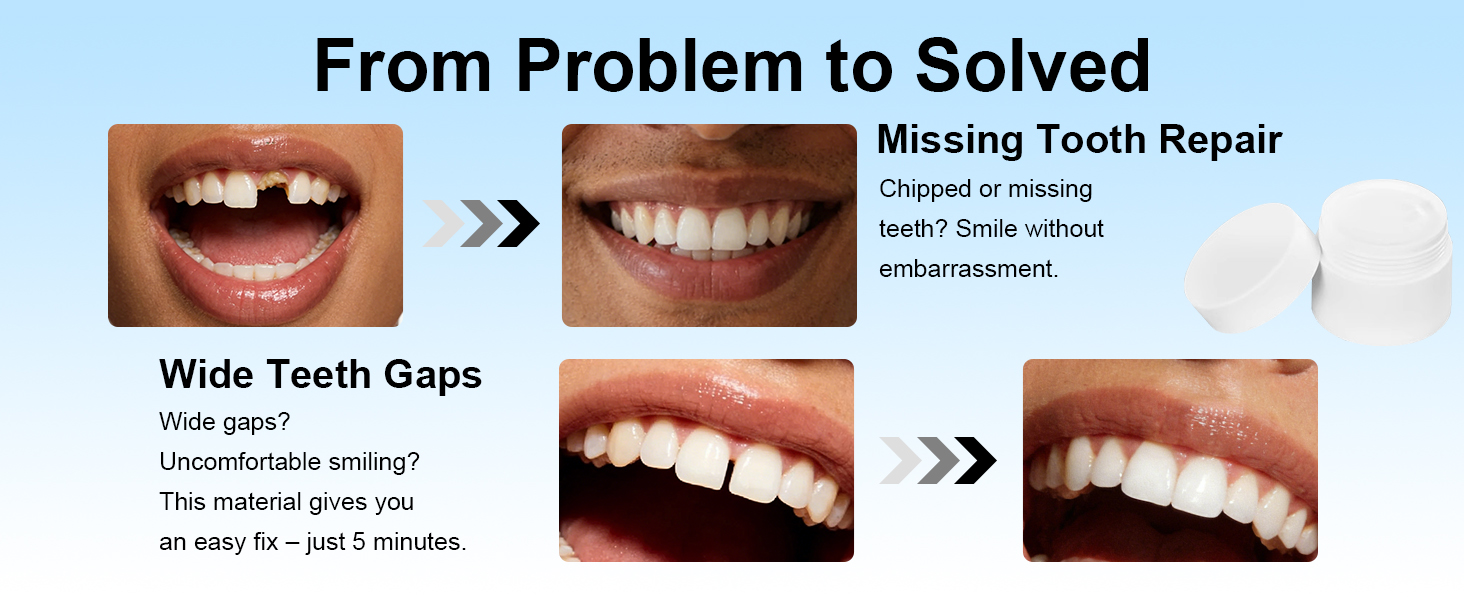 From Problem to Solved. Smile with Confidence in Just 5 Minutes.