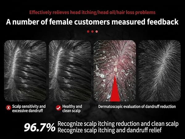 Scalp care results and dandruff reduction