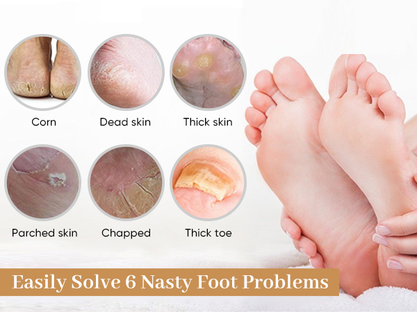 Foot File