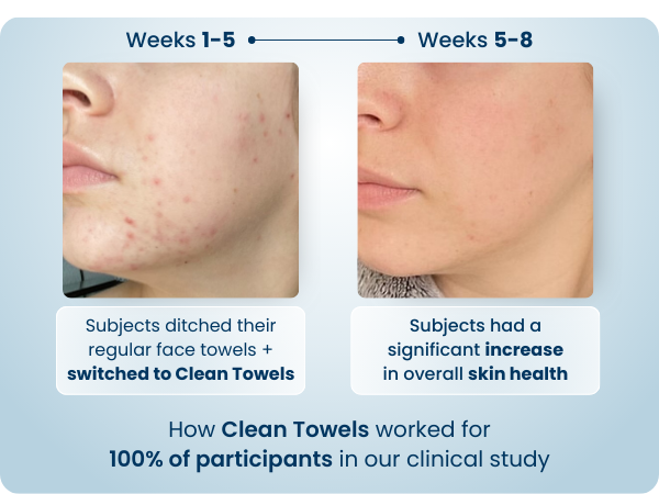 face towel