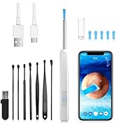 Ear Wax Removal, 1080P HD Ear Wax Removal Tool Camera Ear Wax Removal Kit Ear Camera Otoscope wit...