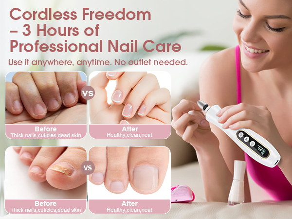 electric nail file