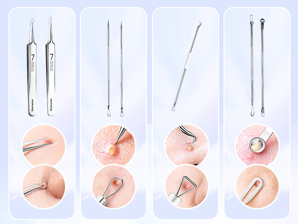 Premium Professional Stainless Acne Pimple Extractor Tool with Metal Box
