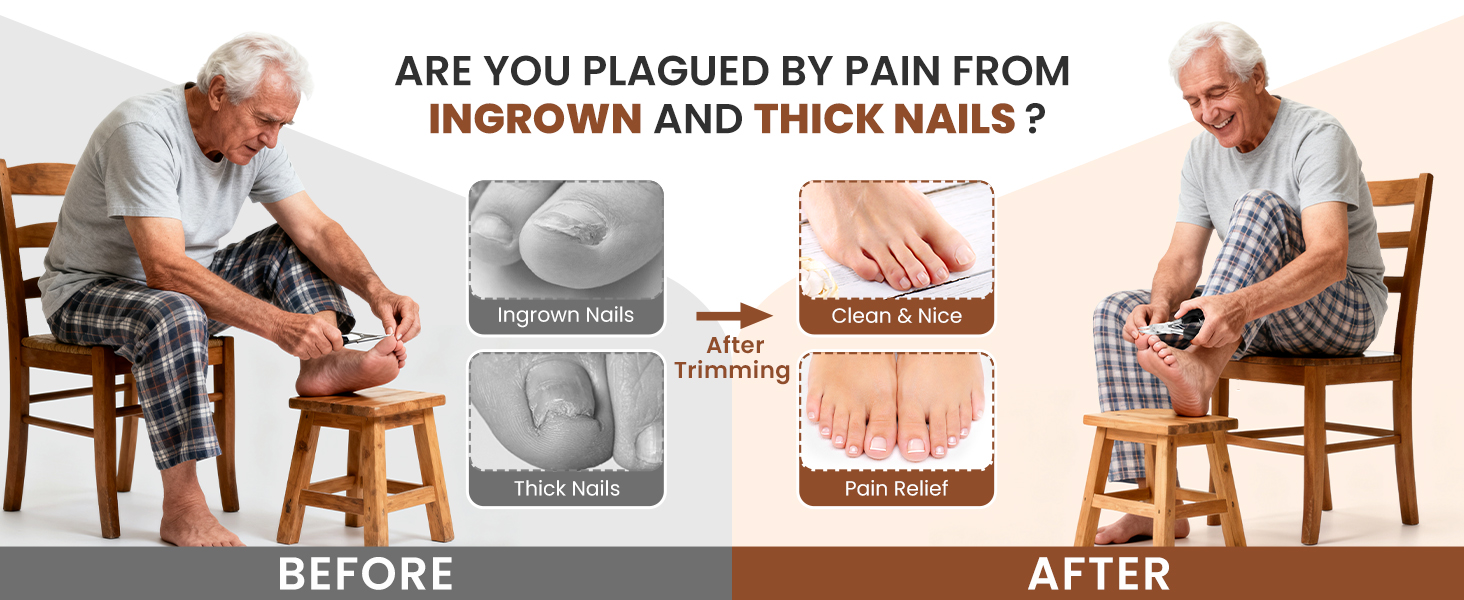 INGROWN AND THICK NAILS