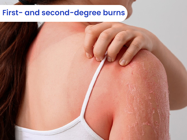 Silicone Foam Dressing