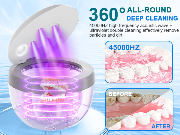 ultrasonic retainer cleaner