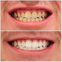oral care toll 