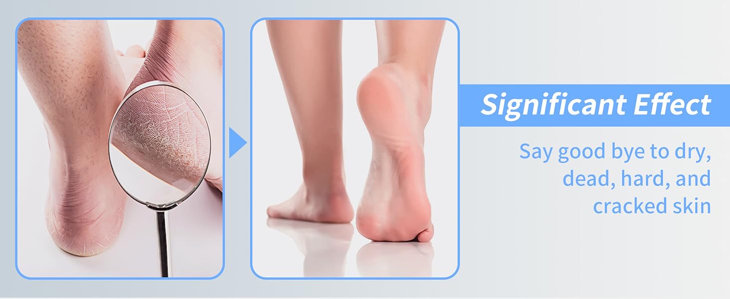 foot file
