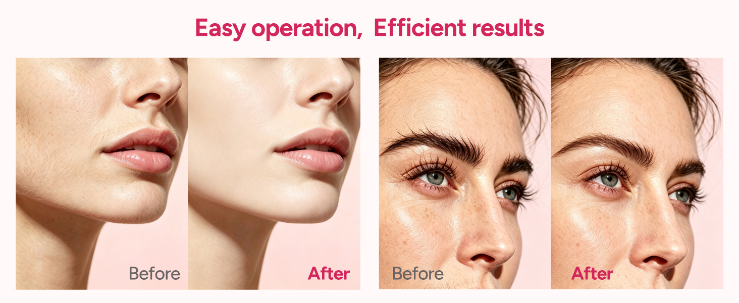 sonic dermaplaning tool