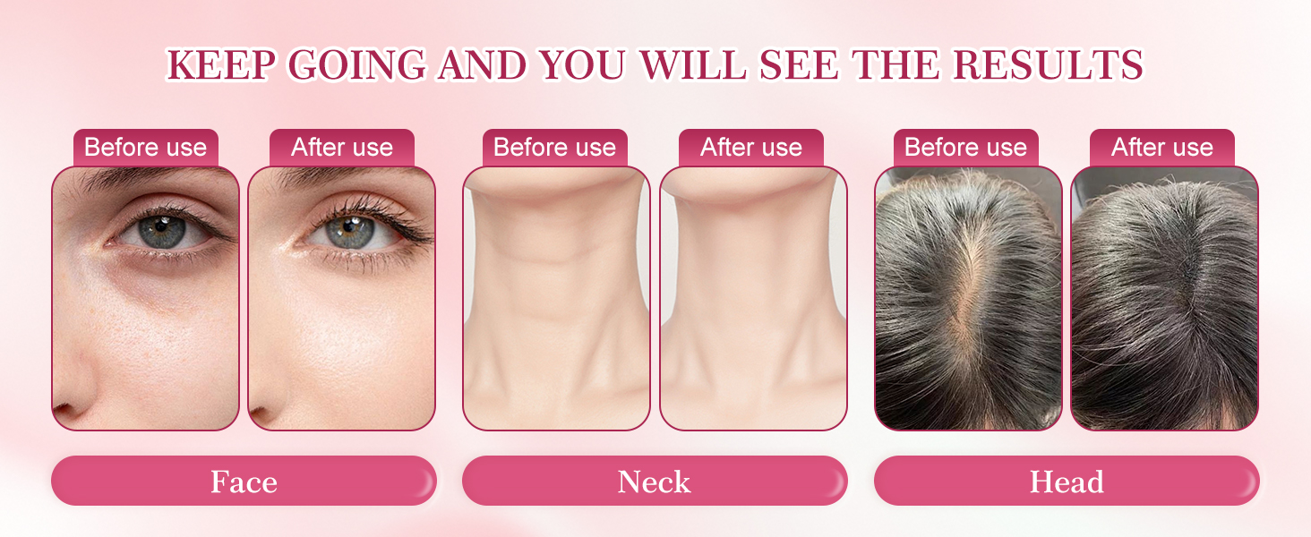 Multi-Functional-Red-Light-Therapy-for-Face and Neck-Eye-Head Massager