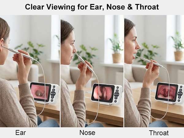 HD screen ear, nose, and throat viewing at home, real-time inspection without app or WiFi