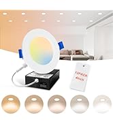 OPONL 12 Pack LED Recessed Lighting 4 Inch with Junction Box, 5CCT Ultra-Thin Recessed Light, 700...