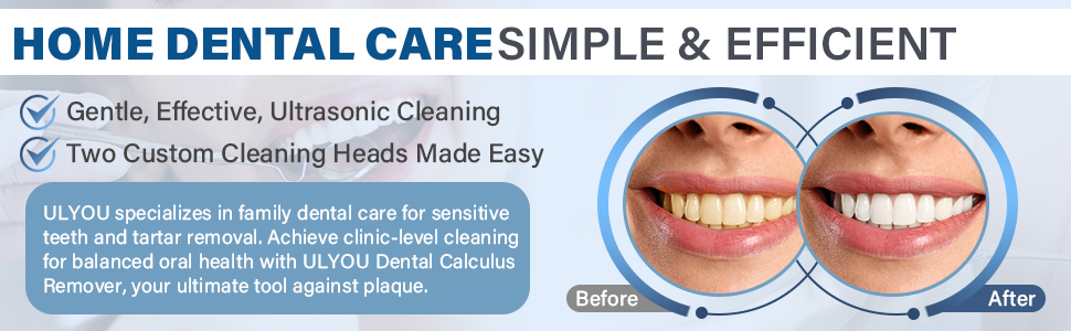 tartar remover for teeth