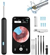 OKUBOX Ear Wax Removal,Earwax Removal Kit with 6LED Light,Ear Cleaner with HD Camera and Light,Wi...