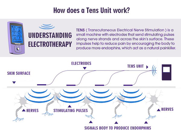 tens unit muscle stimulator