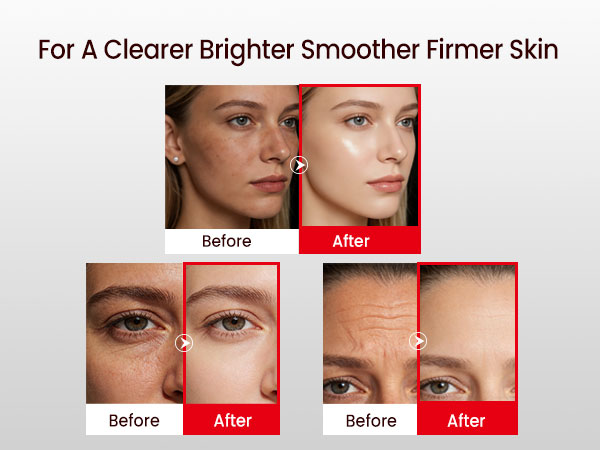 facial massager for lymphatic drainage