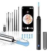 Edicc Ear Wax Removal Tool, Ear Cleaner with Ear Camera, 1296P Ear Scope, Earwax Remover Picker w...