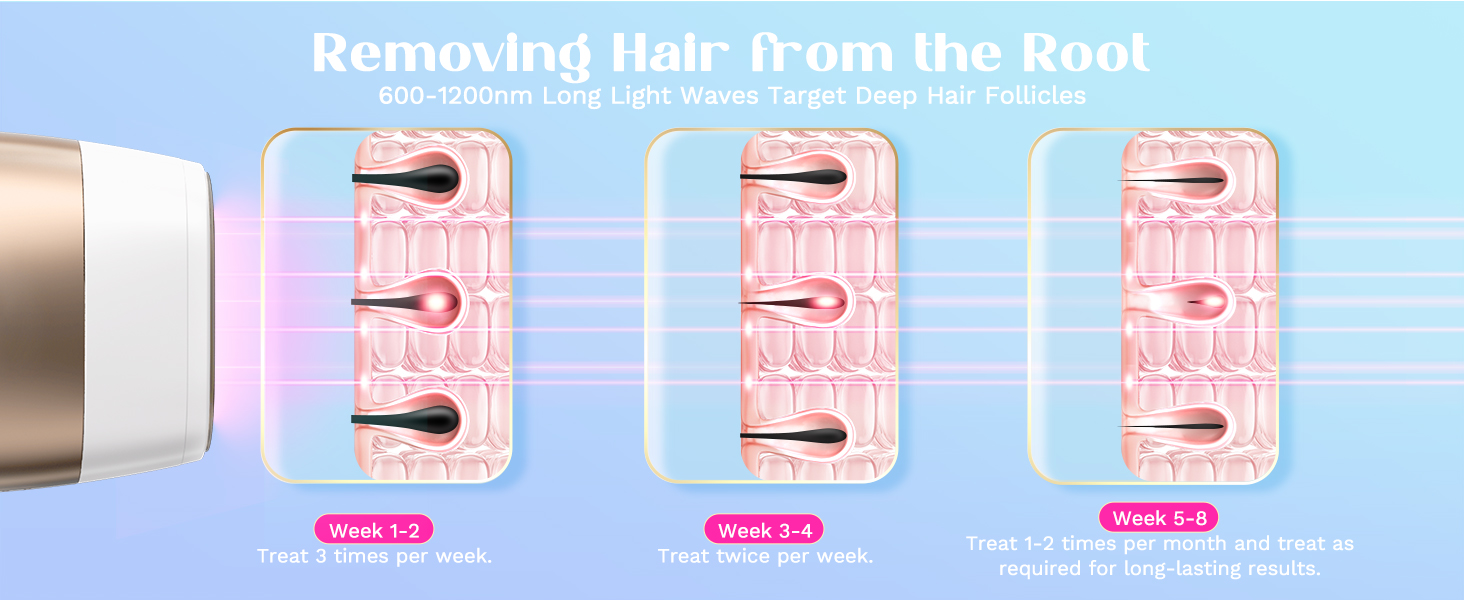 Three-step diagram showing hair removal process with device, illustrating root extraction sequence on pink background with technical indicators.