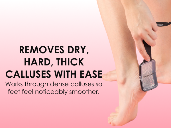 wet and dry callus remover