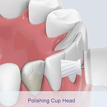 tooth polish