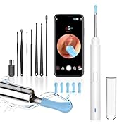 Ear Wax Removal, Ear Cleaner with Camera, Ears Wax Removal Kit with 1296P HD Ear Otoscope with 6 ...