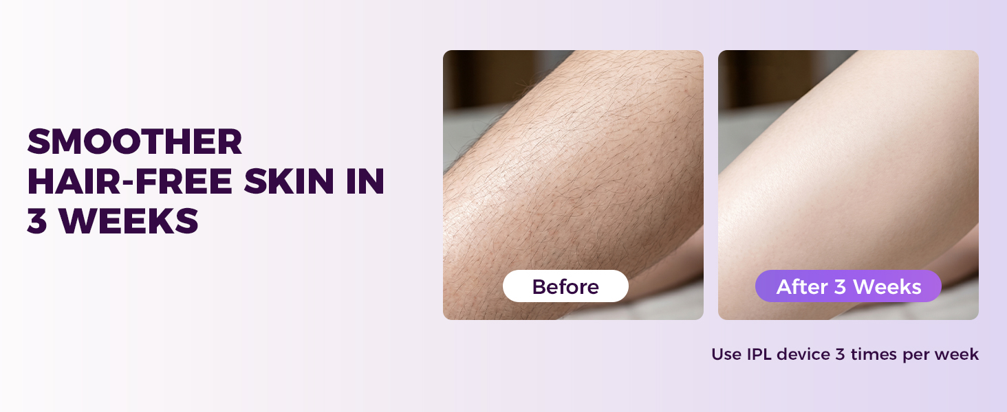 bikini hair removal device