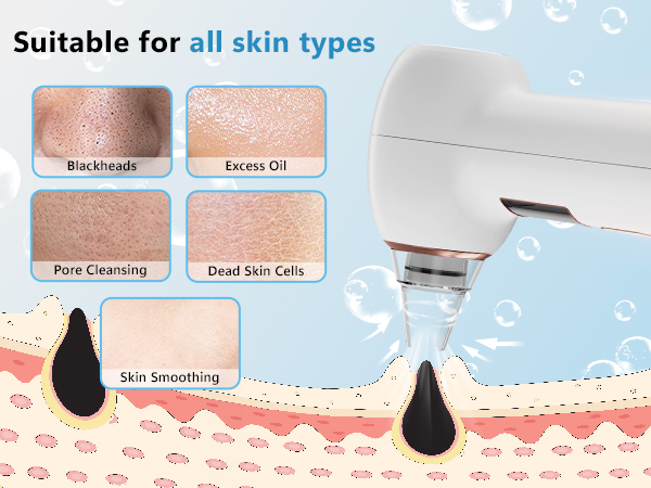 Suitable for all skin types