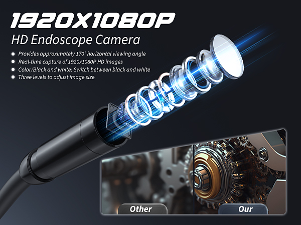 endoscope