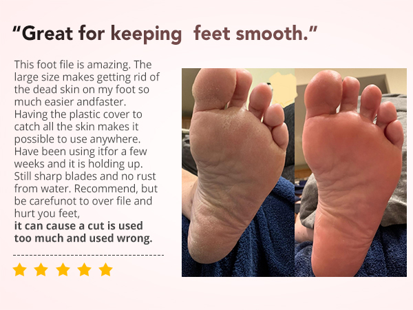Heel Files for Feet