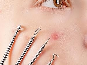 Acne Pimple Extractor Tool