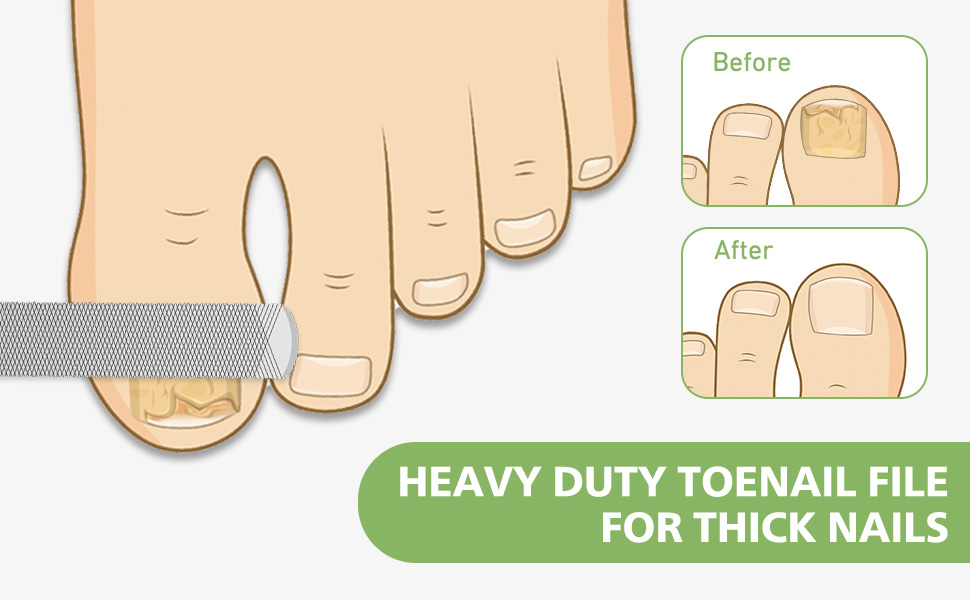 toenail file for thick nails