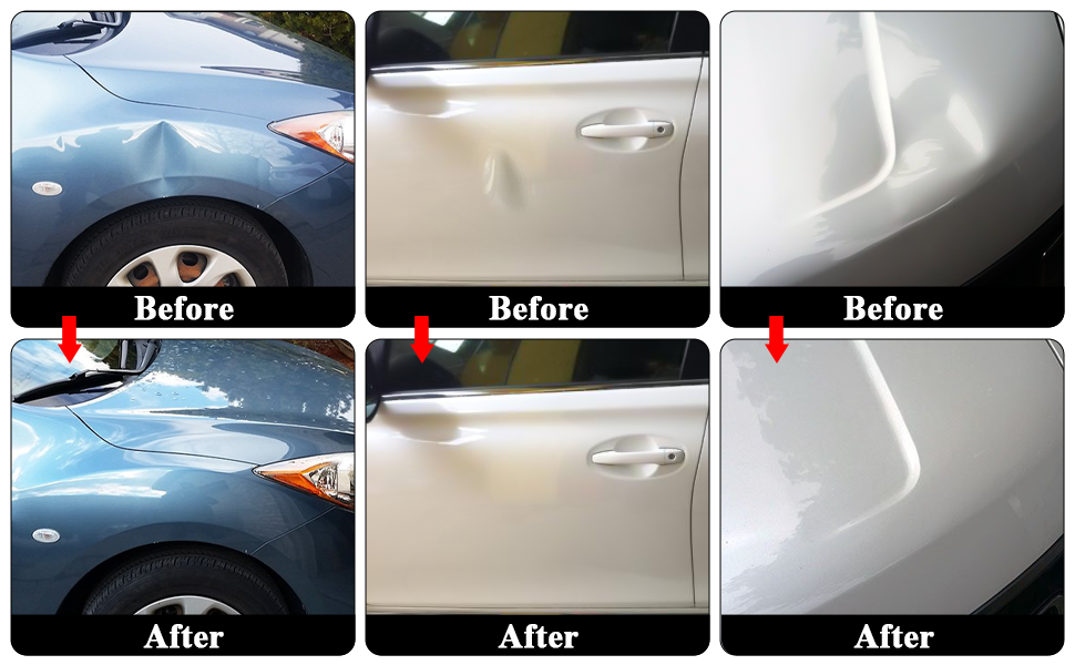 Car Dent Puller - Dent Repair Kit, Dent Removal Kit with Golden Lifter