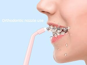 Orthodontic use