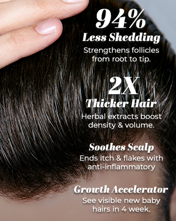 hair loss shampoo