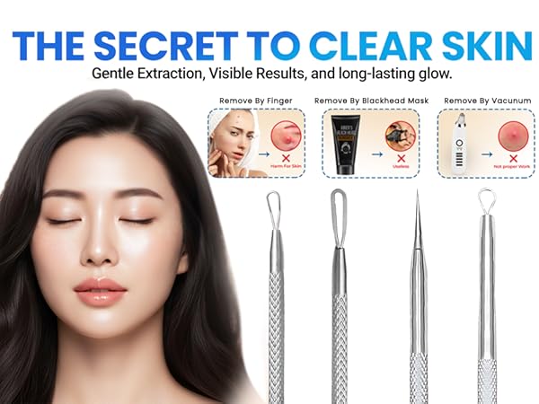 stainless steel pimple extractor