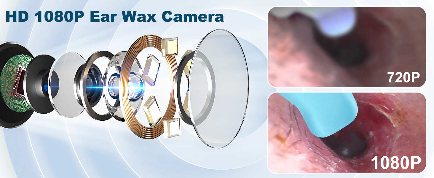 ear camera wax removal